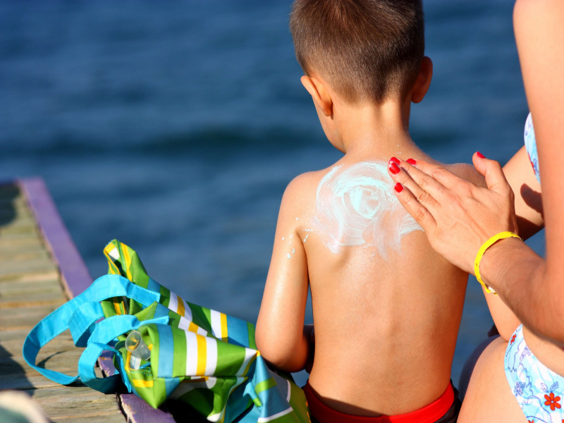 درمان آفتاب سوختگی کودکان و رهایی از درد و سوزش با روش های خانگی
