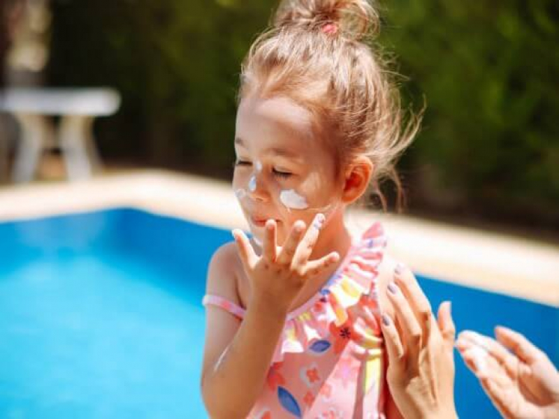 درمان آفتاب سوختگی بچه ها در خانه
